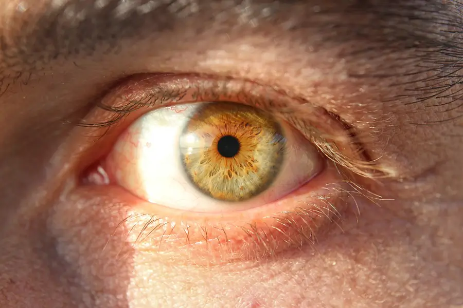 Macular Degeneration: Early Treatment Saves Vision